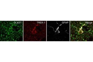 anti-Potassium Channel, Subfamily K, Member 2 (KCNK2) (AA 8-25), (Intracellular) antibody