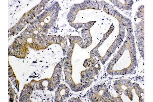 IHC analysis of TIMP4 using anti- TIMP4 antibody .