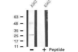 Western blot analysis of extracts from K562 cells, using CDC42EP3 antibody.