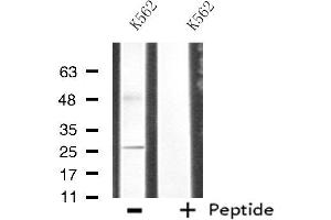 Western blot analysis of extracts from K562 cells, using CDC42EP3 antibody. (CDC42EP3 anticorps  (Internal Region))