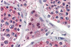Human Testis (formalin-fixed, paraffin-embedded) stained with IDH1 antibody ABIN462259 followed by biotinylated goat anti-rabbit IgG secondary antibody ABIN481713, alkaline phosphatase-streptavidin and chromogen.