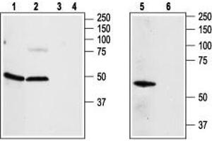 Western blot analysis of rat aortic endothelial cells (lanes 1, 3), rat brain (lanes 2, 4) and Jurkat (lanes 5, 6) lysates:1,2,5. (Adenosine A2a Receptor (ADORA2A) Peptide)