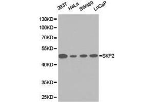 Western Blotting (WB) image for anti-S-Phase Kinase-Associated Protein 2 (SKP2) antibody (ABIN1874793) (SKP2 anticorps)