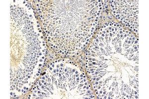 anti-CDP-Diacylglycerol Synthase (Phosphatidate Cytidylyltransferase) 1 (CDS1) antibody