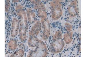 Detection of COL4a1 in Human Stomach Tissue using Polyclonal Antibody to Collagen Type IV Alpha 1 (COL4a1)