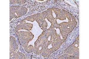 IHC analysis of ECHS1 using anti-ECHS1 antibody (ABIN7599813).