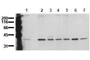 Western Blotting (WB) image for anti-Mitogen-Activated Protein Kinase 14 (MAPK14) (N-Term) antibody (ABIN126883) (MAPK14 anticorps  (N-Term))