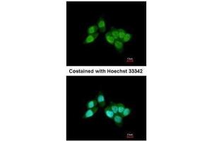 ICC/IF Image Immunofluorescence analysis of paraformaldehyde-fixed A431, using RCC1, antibody at 1:200 dilution. (RCC1 anticorps)