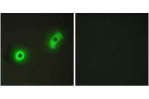 Immunofluorescence (IF) image for anti-Cdk5 and Abl Enzyme Substrate 2 (CABLES2) (AA 91-140) antibody (ABIN2889872) (CABLES2 anticorps  (AA 91-140))