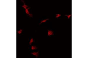 ABIN6275059 staining Hela by IF/ICC. (DKK3 anticorps  (C-Term))
