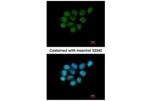 ICC/IF Image Immunofluorescence analysis of paraformaldehyde-fixed A431, using ARIH2, antibody at 1:200 dilution.