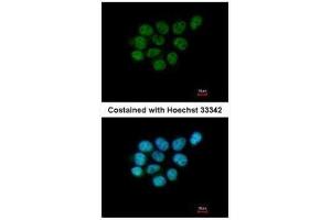 ICC/IF Image Immunofluorescence analysis of paraformaldehyde-fixed A431, using ARIH2, antibody at 1:200 dilution. (ARIH2 anticorps  (C-Term))