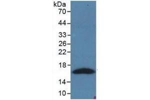 WB of Protein Standard: different control antibodies  against Highly purified E. (PRO-ANP Kit ELISA)