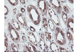 Image no. 5 for anti-RAB, Member of RAS Oncogene Family-Like 2A (RABL2A) antibody (ABIN1500575)