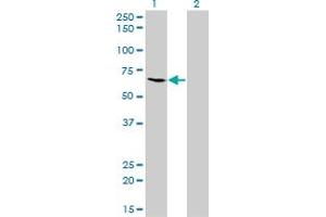 Western Blot analysis of ME1 expression in transfected 293T cell line by ME1 monoclonal antibody (M03), clone 3H5.