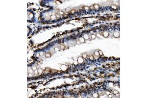 IHC analysis of USP16 using anti-USP16 antibody (ABIN7602640). (USP16 anticorps  (AA 9-823))