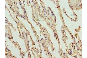 Immunohistochemistry of paraffin-embedded human lung tissue using ABIN7151751 at dilution of 1:100 (PROCR anticorps  (AA 18-210))