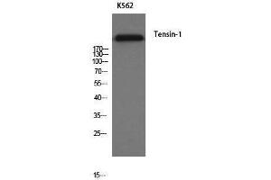 Western Blotting (WB) image for anti-Tensin 1 (TNS1) antibody (ABIN3180912) (Tensin 1 anticorps)