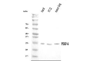 Western blot analysis of PDGF AA/PDGFA using anti-PDGF AA/PDGFA antibody (ABIN7602580). (PDGFA anticorps  (AA 87-211))
