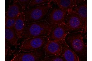 Immunofluorescence staining of methanol-fixed MCF7 cells using IGF-1R (phospho-Tyr1161) antibody.