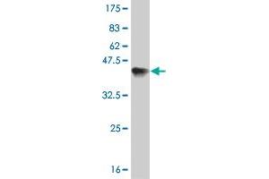 Western Blot detection against Immunogen (36. (ERN1 anticorps  (AA 401-500))