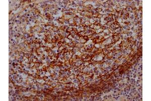 IHC image of ABIN7127406 diluted at 1:100 and staining in paraffin-embedded human lung tissue performed on a Leica BondTM system.