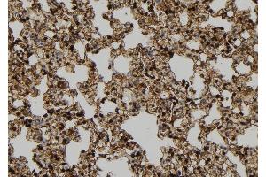 ABIN6278961 at 1/100 staining Rat lung tissue by IHC-P.