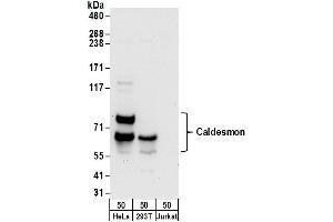 Western Blotting (WB) image for anti-Caldesmon 1 (CALD1) (AA 743-793) antibody (ABIN7455009)