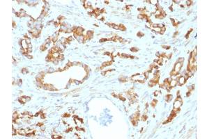 Formalin-fixed, paraffin-embedded human Prostate stained with Aurora B Mouse Monoclonal Antibody (AURKB/1593).