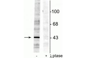Western blot of rat testes lysate showing specific immunolabeling of the ~46 kDa EphrinB phosphorylated at Tyr298 in the first lane (-). (EPH Receptor B2 anticorps  (pTyr298))