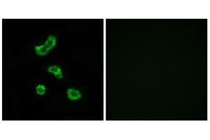 Immunofluorescence analysis of MCF-7 cells, using CA5B antibody.