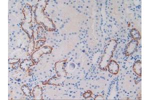 IHC-P analysis of Human Kidney Tissue, with DAB staining. (c-MET anticorps  (AA 1092-1379))
