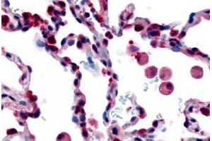 Human Lung, Alveolar Macrophages (formalin-fixed, paraffin-embedded) stained with FFAR2 antibody ABIN213512 at 35 ug/ml followed by biotinylated goat anti-rabbit IgG secondary antibody ABIN481713, alkaline phosphatase-streptavidin and chromogen. (FFAR2 anticorps  (Extracellular Domain))