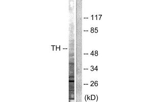 Western Blotting (WB) image for anti-Tyrosine Hydroxylase (TH) (Ser19) antibody (ABIN1847900)
