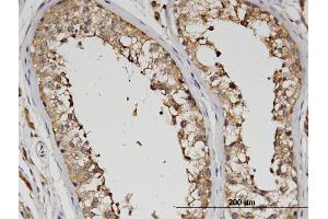 Immunoperoxidase of monoclonal antibody to SLC13A5 on formalin-fixed paraffin-embedded human testis.