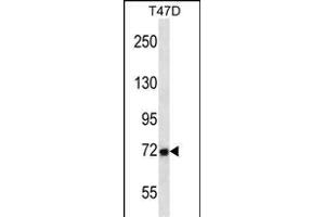 P2 Antibody (Center) (ABIN657616 and ABIN2846612) western blot analysis in T47D cell line lysates (35 μg/lane). (MMP2 anticorps  (AA 303-331))