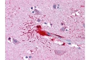 Human Brain, Cortex: Formalin-Fixed, Paraffin-Embedded (FFPE) (LHX8 anticorps)