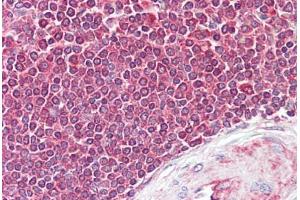 Anti-EIF4B antibody IHC staining of human spleen. (EIF4B anticorps  (AA 150-200))