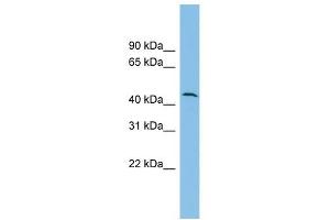DPH1 antibody used at 1 ug/ml to detect target protein. (DPH1 anticorps)