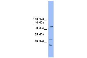 WB Suggested Anti-STARD8 Antibody Titration: 1.