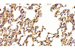 Detection of ACE in Rat Lung Tissue using Polyclonal Antibody to Angiotensin I Converting Enzyme (ACE)