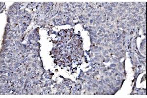 IHC analysis of SLFN11 using anti-SLFN11 antibody (ABIN7599761). (SLFN11 anticorps  (AA 114-794))