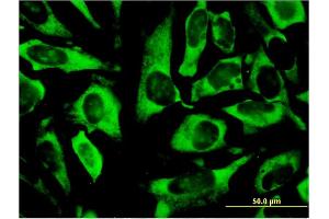 Immunofluorescence of monoclonal antibody to RPLP0 on HeLa cell.