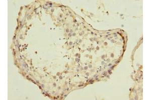Immunohistochemistry of paraffin-embedded human testis tissue using ABIN7151602 at dilution of 1:100 (ESRG anticorps  (AA 1-222))