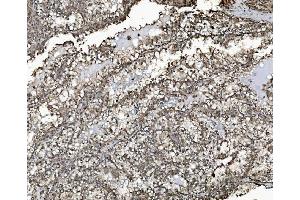 IHC analysis of REA/PHB2 using anti-REA/PHB2 antibody (ABIN7599239). (Prohibitin 2 anticorps  (AA 1-299))