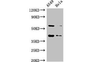 Western Blot Positive WB detected in: A549 whole cell lysate, Hela whole cell lysate All lanes: SMN1 antibody at 2 μg/mL Secondary Goat polyclonal to rabbit IgG at 1/50000 dilution Predicted band size: 32, 29, 31, 28 kDa Observed band size: 40, 60 kDa (SMN1 anticorps  (AA 3-194))