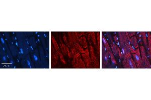Rabbit Anti-PARD3 Antibody   Formalin Fixed Paraffin Embedded Tissue: Human heart Tissue Observed Staining: Cytoplasmic, plasma membrane in intercalated disc Primary Antibody Concentration: N/A Other Working Concentrations: 1:600 Secondary Antibody: Donkey anti-Rabbit-Cy3 Secondary Antibody Concentration: 1:200 Magnification: 20X Exposure Time: 0.