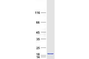 Validation with Western Blot (PFDN6 Protein (Myc-DYKDDDDK Tag))
