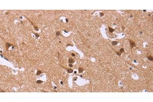 Immunohistochemistry of paraffin-embedded Human brain tissue using DCBLD2 Polyclonal Antibody at dilution 1:50 (DCBLD2 anticorps)