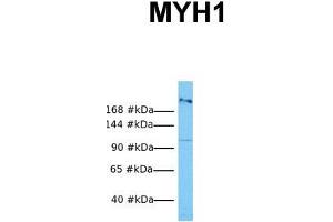 Host:  Rabbit  Target Name:  MYH1  Sample Tissue:  Human OVCAR-3  Antibody Dilution:  1.